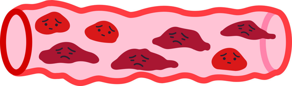 ＬＤＬ(悪玉コレステロール)より怖い“〇〇ＬＤＬ”